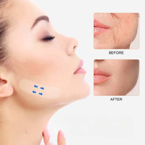 ElegantieLift - Een delicaat V-gezicht kan worden bereikt met Face Lifter Tape