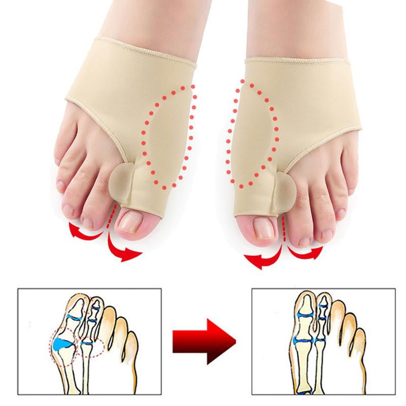 SootheStep | Hallux Valgus Orthopedische Beschermer (1 paar)